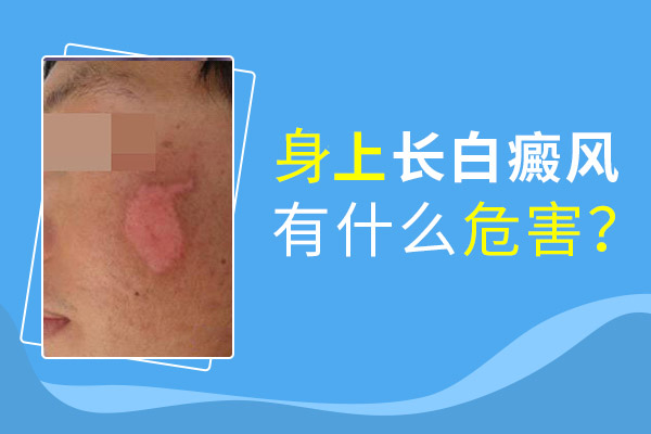 合肥華研白癜風(fēng)醫(yī)院